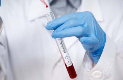 hematoloji (1) hematoloji (1)